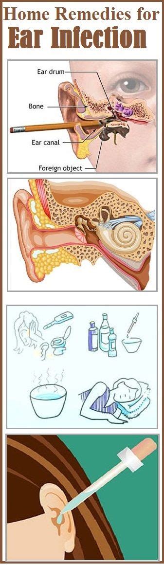 Home Remedies for Ear Infection | Home health remedies, Remedies, Ear ...