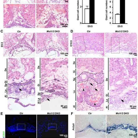 Impaired differentiation of trophoblast giant cells and... | Download ...