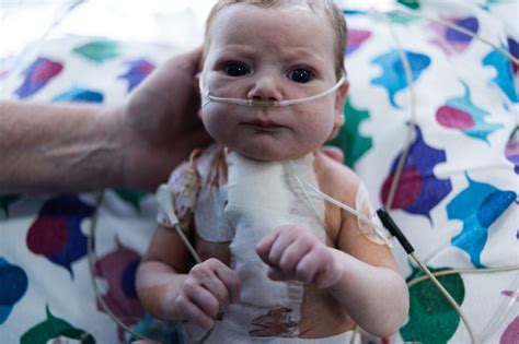 ‘Chernobyl Heart’ war- zone baby saved by Irish-funded surgical team ...