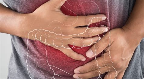 Chronic constipation: tips for advanced practice providers - American Gastroenterological ...