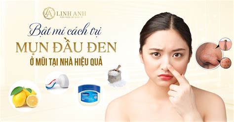 11 Cách trị mụn đầu đen ở mũi tại nhà đơn giản, CỰC HIỆU QUẢ - Cosy