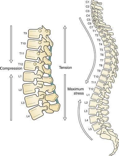 Thoracolumbar Spine Fractures | Neupsy Key