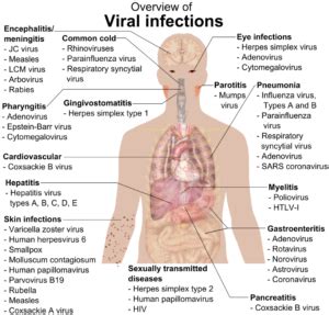 Types of Diseases: Classification of Diseases with Questions and Videos