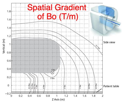 Spatial gradient field - Questions and Answers in MRI