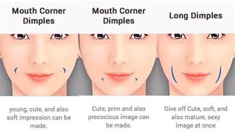 Types Of Dimples