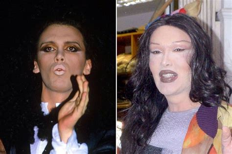 Pete Burns before and after plastic surgery 38 – Celebrity plastic ...