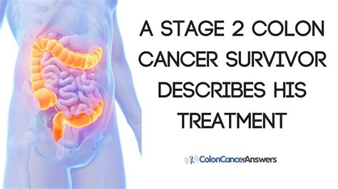 Stage 2 Colon Cancer Survivor Stories - CancerWalls