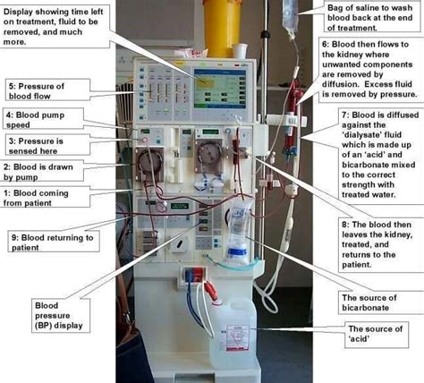 Approach to new advances in dialysis | Middle East Medical Portal