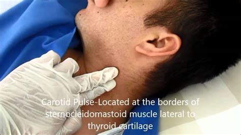 Locating Pulse : Temporal, Carotid, Facial and Apical Pulse page 3 of 3 ...