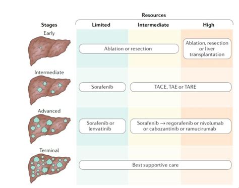 Strategy for HCC treatment in countries with different resource levels ...