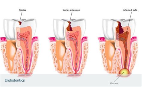 Type Of Dentistry - Dental News Network