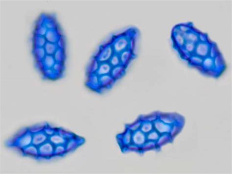 Microscopy of spores, hyphae, cystidia, trama, to identify fungi