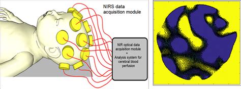 (Left) Diagram of neonatal NIR spectroscopy (NIRS) imaging. A series of... | Download Scientific ...