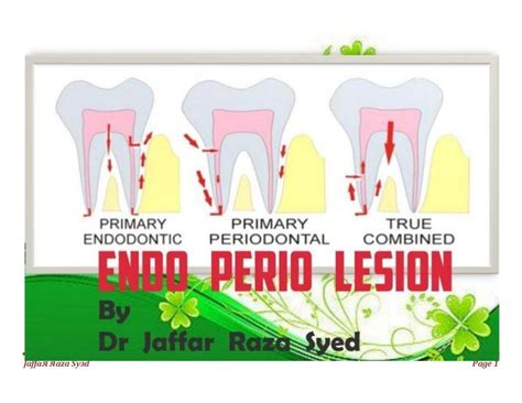 038. endo perio lesions