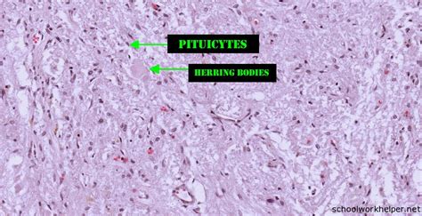 pars-nervosa-slide-labelled-histology | SchoolWorkHelper