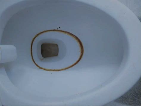 How to Get Rid of a Toilet Ring Without Scratching the Bowl - Toilet Haven