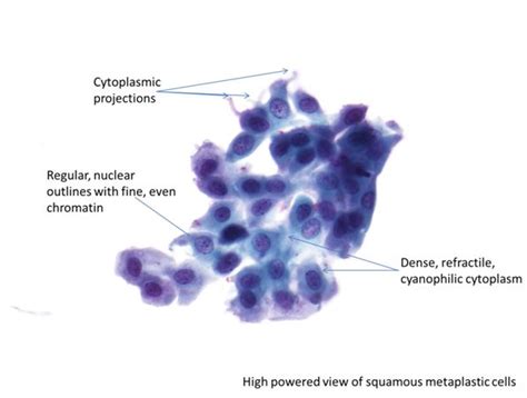 9b. Normal cytology and benign reactive changes | Eurocytology | Pap ...