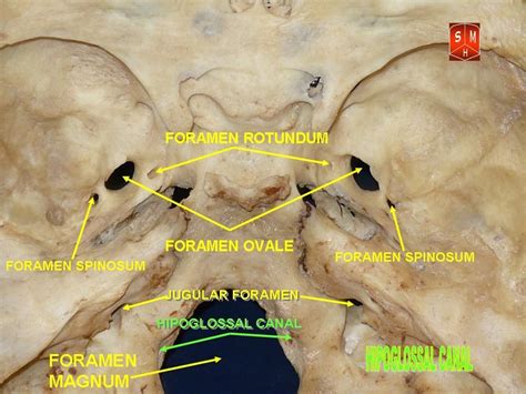 Hypoglossal canal vs foramen magnum? : r/Anatomy