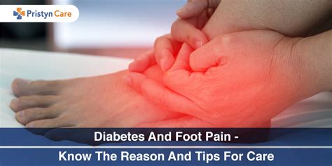 Diabetes foot pain symptoms | doctorvisit