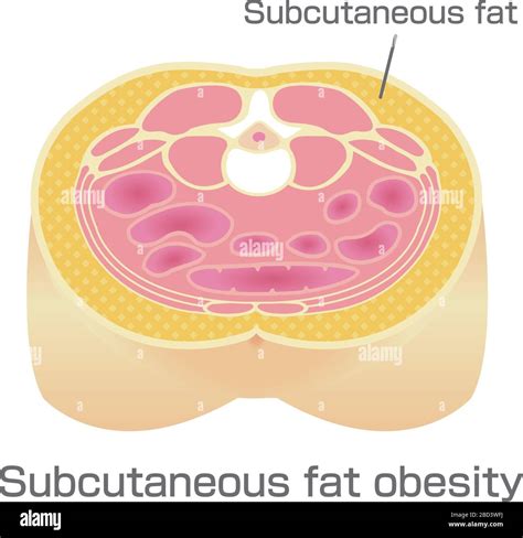 Subcutaneous Fat High Resolution Stock Photography and Images - Alamy