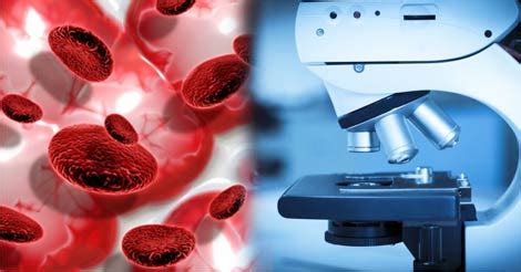 Blood Cancer Diagnosis & Prognosis | Test & Treatment Cost