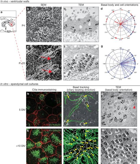 Progressive orientation of ependymal cilia during development. (a)... | Download Scientific Diagram