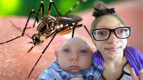 Scientists Discover Why Zika Causes Small Head In Babies - Suchablog