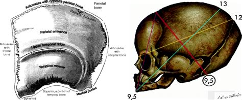 Asynclitism: Clinical and Intrapartum Diagnosis in Labor | Radiology Key