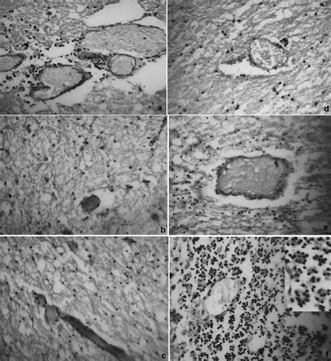 The Fatal Case of Lyssavirus Encephalitis in the Russian Far East ...