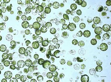 Freshly isolated tobacco protoplasts. Scale bar indicates 20 μm | Download Scientific Diagram