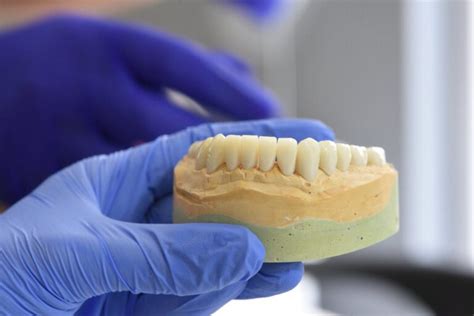 Stages of a Loose Tooth in Adults - Smile Cliniq