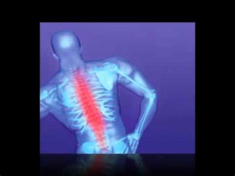 Acute Pain Treatment - YouTube