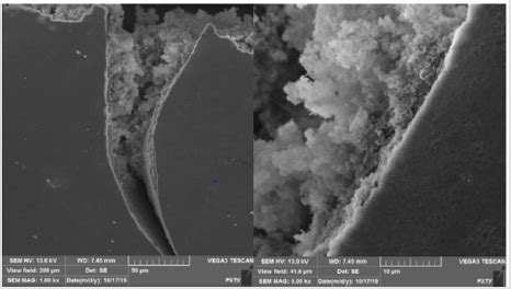 Prospects for Regeneration Solid Tooth Tissues by Synthesis of Biocompatible Hydroxyapatite in ...