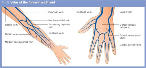 Peripheral Vascular Access - Sites, Indications & Contraindications