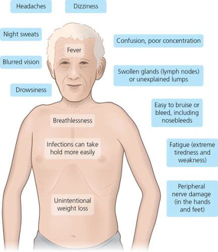 Waldenström Macroglobulinemia: Possible Effects - The Waiting Room