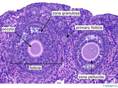 Ovary Histology - Ovary (labels) - histology slide