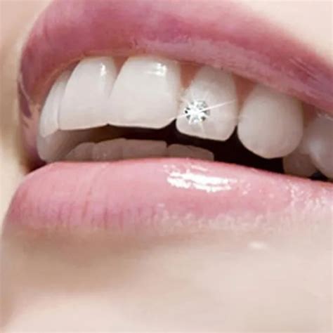 10Pcs Tooth Diamond Crystal Ornament Dental Material Decoration Temporary Teeth Jewels Bur ...