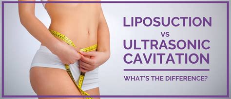 Liposuction vs Ultrasonic Cavitation | Eureka Body Care & Spa