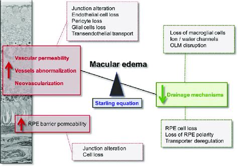 Pathophysiological mechanisms leading to macular edema. Macular edema... | Download Scientific ...