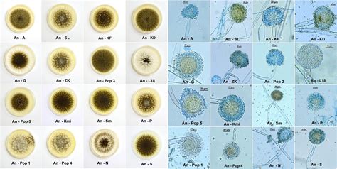 Aspergillus Microscope Label