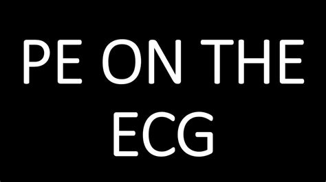 PE ECG - YouTube