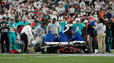 Can you fly with a concussion? What to know after Tua Tagovailoa hit