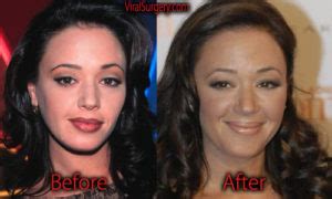 Leah Remini Plastic Surgery: Before and After Botox, Boob Job Pictures