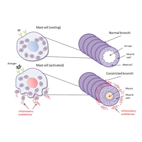 Targeting Cell Signaling In Allergic Asthma Signal, 48% OFF