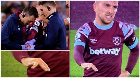 West ham star Jarrod Bowen suffered finger injury after scoring vs ...