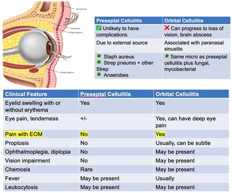 Preseptal Cellulitis Vs Orbital Cellulitis