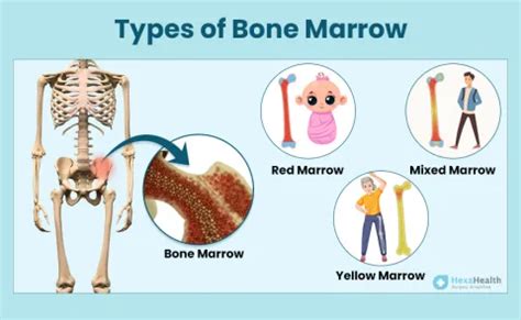 What are the Different Types of Bone Marrow in Body?