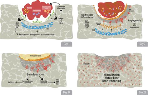 Regenerative Medicine: A New Paradigm in Bone Regeneration | IntechOpen