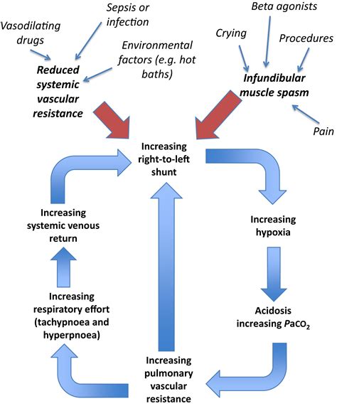 Tetralogy of Fallot - BJA Education