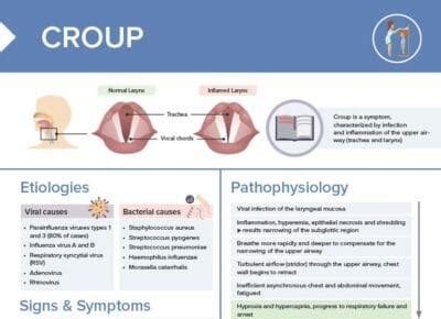 Croup vs Whooping Cough [+ Free Cheat Sheet] | Lecturio